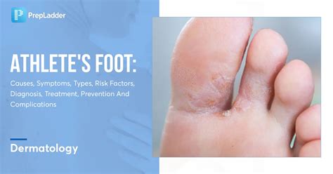 jock feet|Athlete’s Foot Bumps: Symptoms, Diagnosis, & Treatment.